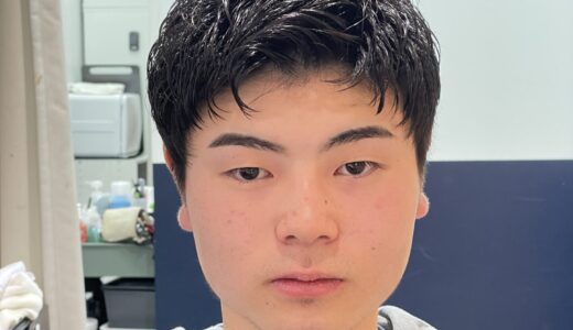直毛・サイドの膨らみにコテパーマ｜銀座の施術実例・料金・持ち